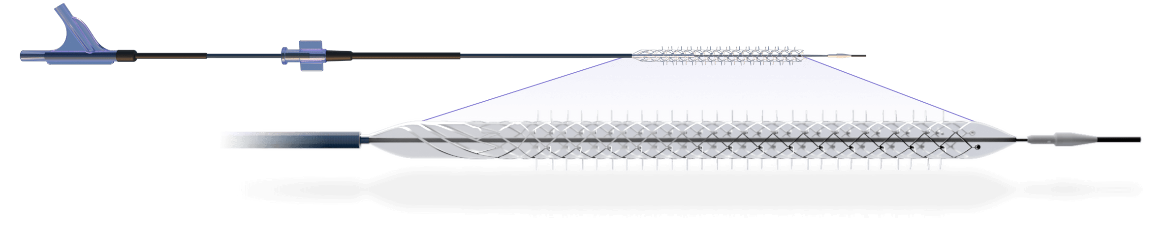 Reflow Medical s Bare Temporary Stent System Studied in DEEPER OUS